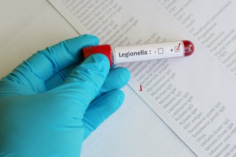 Legionnaires’ disease